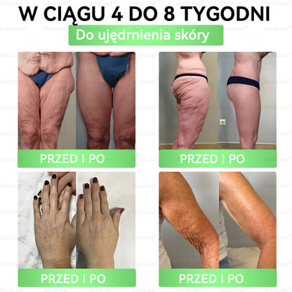 ♻️𝖮𝖋𝗶𝗰𝗷𝗮𝗹𝗻𝘆 𝘀𝗸𝗹𝗲𝗽 | 👩‍⚕️𝘽𝙪𝙞𝙡𝙙𝙇𝙚𝙖𝙛® 𝗚𝗟𝗣-𝟭 𝟖-w-𝟭 Smukły i zdrowy roztwór doustny (𝑟𝑎𝑧 𝑑𝑧𝑖𝑒𝑛𝑛𝑖𝑒, 𝑟𝑒𝑧𝑢𝑙𝑡𝑎𝑡𝑦 𝑤 7 𝑑𝑛𝑖),Wspiera odchudzanie, serce, cukrzycę, sen, jelita, stawy, a także ujędrnia skórę i dodaje energii